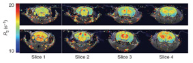 Ferritin-induced contrast